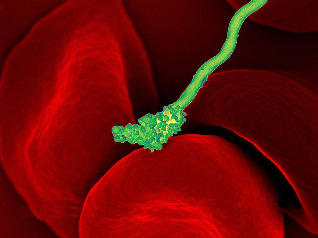 Image shows a large red blood cell, with a filamentous green bacterium resting on its surface.
