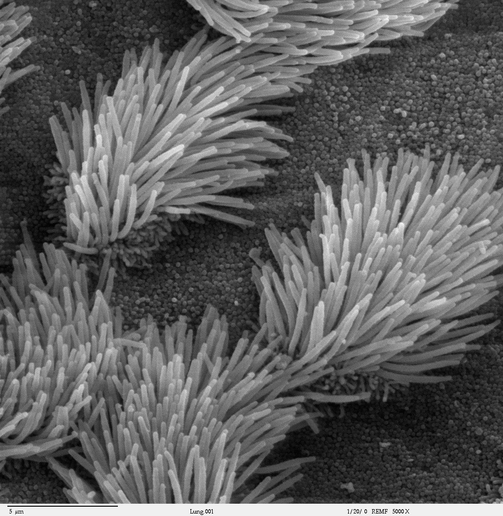 Image shows a scanning electron microscope image of the interior surface of bronchi. The cells lining the interior of this tube have clumps of cilia.