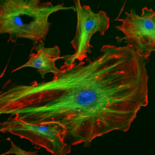 The cytoskeleton gives the cell an internal structure, like the frame of a house. In this photograph, filaments and tubules of the cytoskeleton have been stained green and red, respectively, so that they can be seen clearly. The blue dots are cell nuclei.