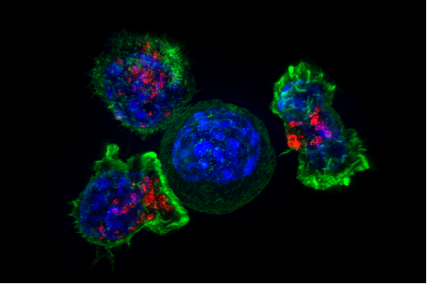 Figure 17.5.1 Killer T Cells