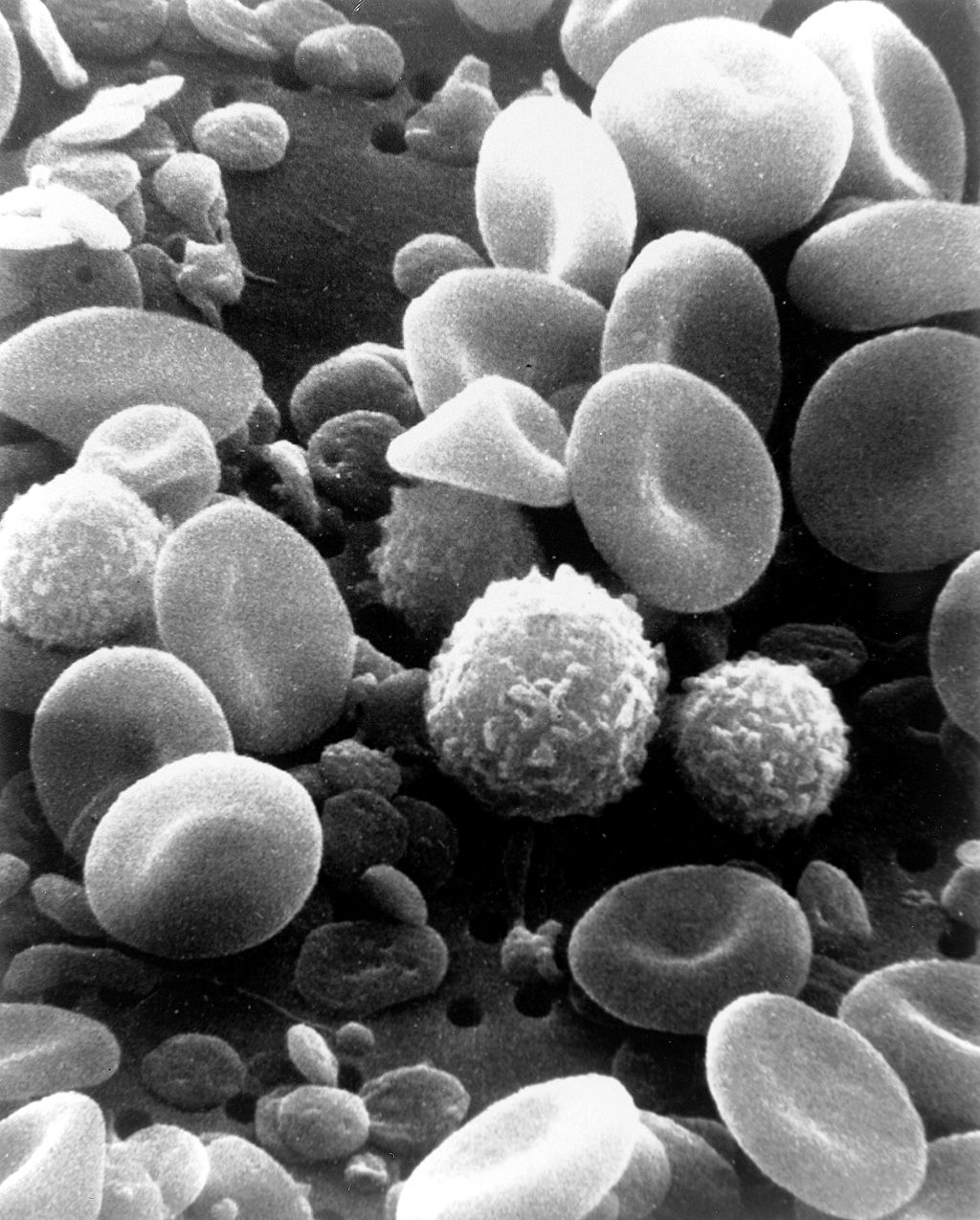14.5.3 SEM Blood Cells