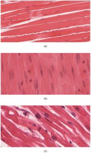12.3 Three muscle tissue types: skeletal mjuscle, smooth muscle and cardiac muscle.
