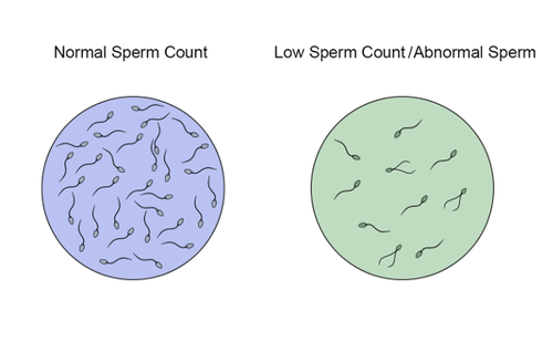 18.12.3 Sperm Count