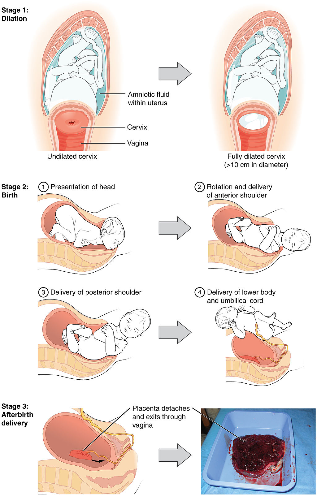 18.7.6 Stages of Labor