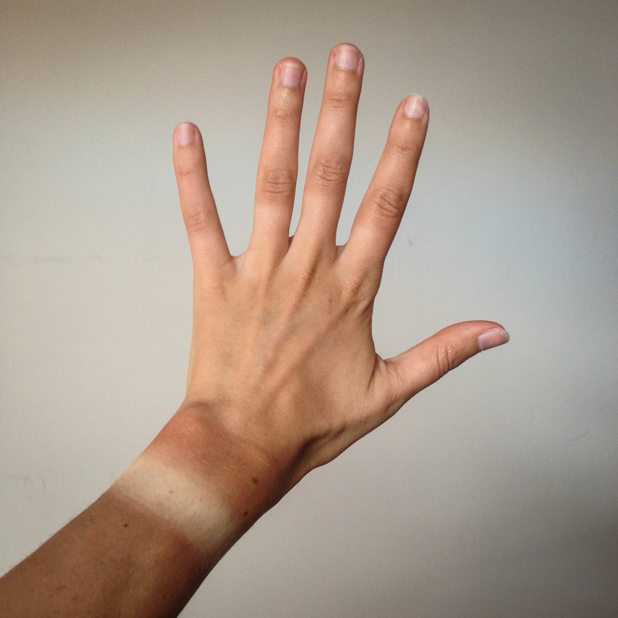 Image shows a hand with a tan line where a watch had been worn.