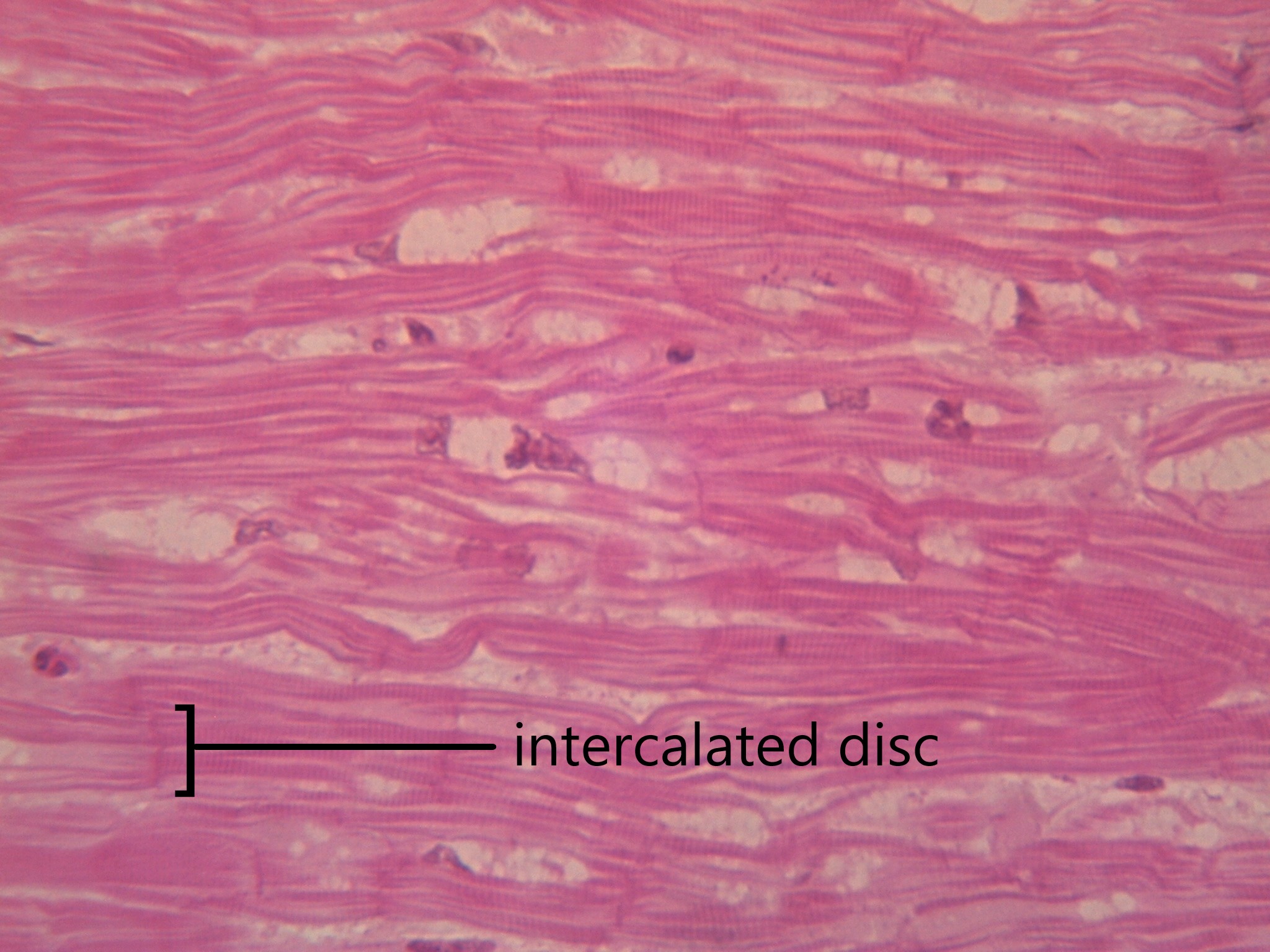 3.5: Muscle Tissue - Medicine LibreTexts