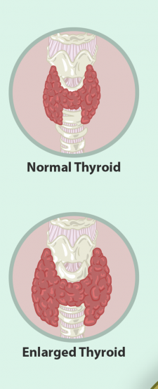 9.5 Thyroid Gland – Human Biology