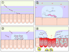 15.7 Disorders of the Gastrointestinal Tract – Human Biology