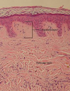 10.4 Dermis – Human Biology