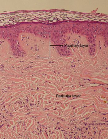 10-4-dermis-human-biology