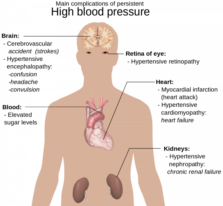 Reducing Cardiovascular Disease Risk