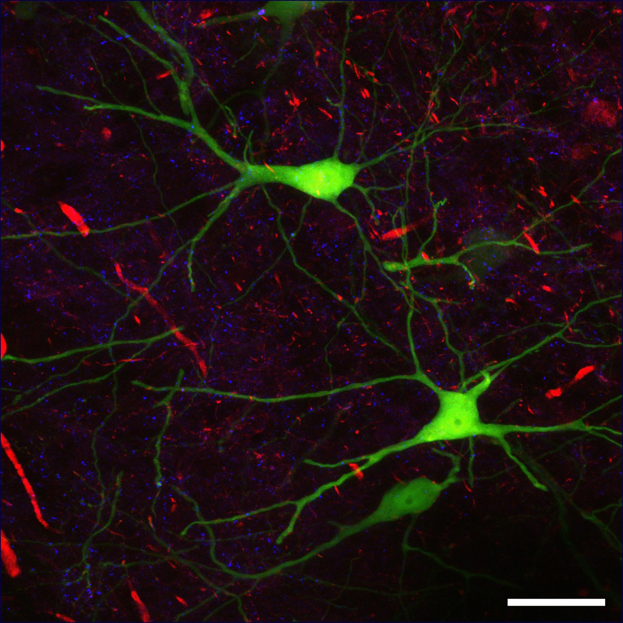 8.3 Neurons and Neuroglia – Human Biology