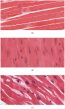 12.3 Types of Muscle Tissue – Human Biology