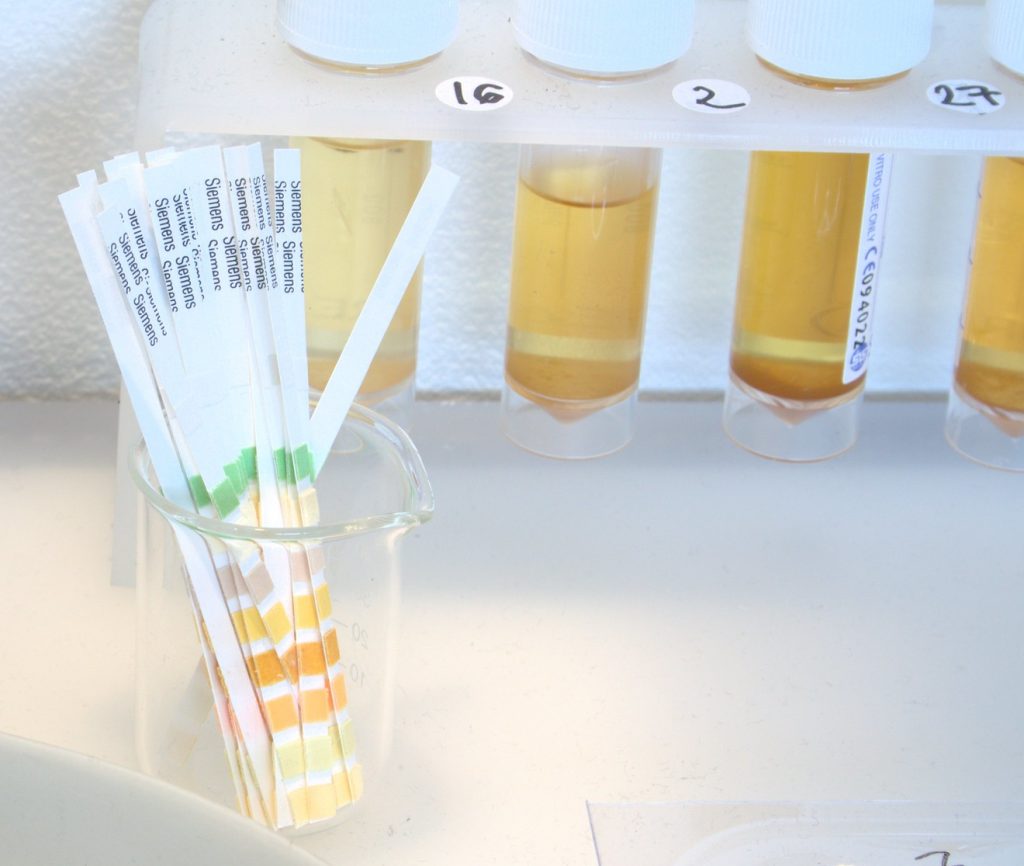 16.6 Disorders of the Urinary System Human Biology