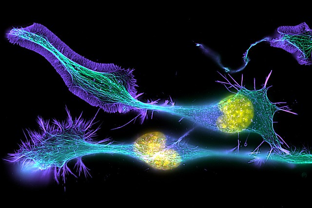 Developing neurons