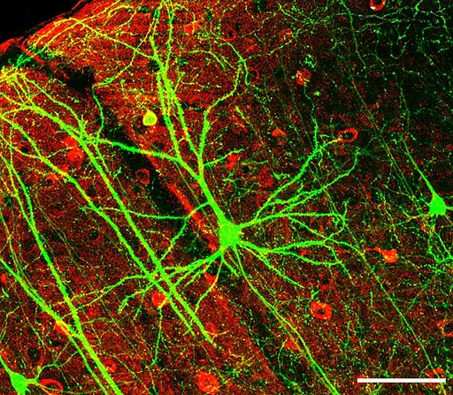 Neuron: conducts electrical impulses